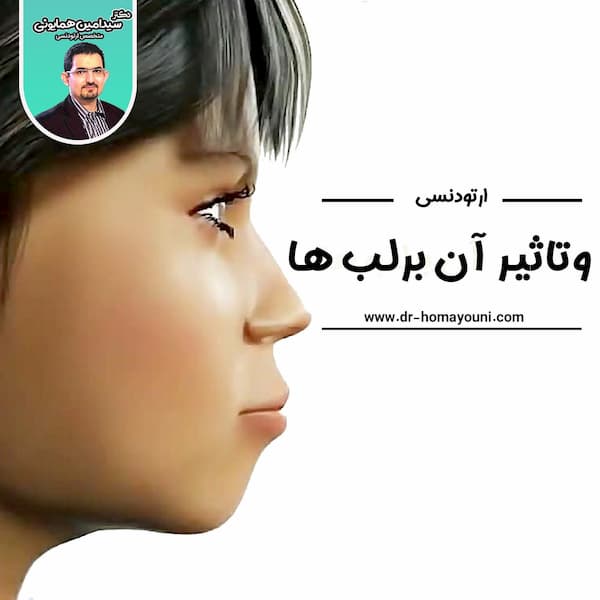 ارتودنسی و تاثیر آن بر لب ها