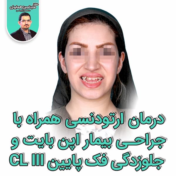 جراحی فک بیمار اپن بایت