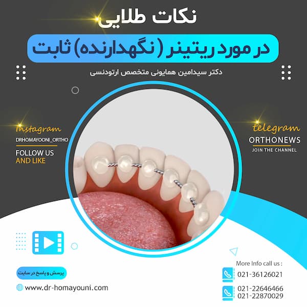 نکات طلایی در مورد ریتینر (نگهدارنده)ثابت