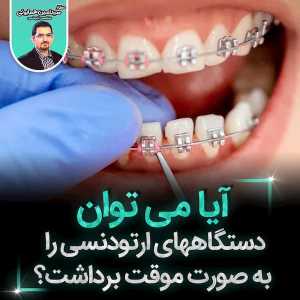 می توان دستگاههای ارتودنسی به صورت موقت برداشت؟