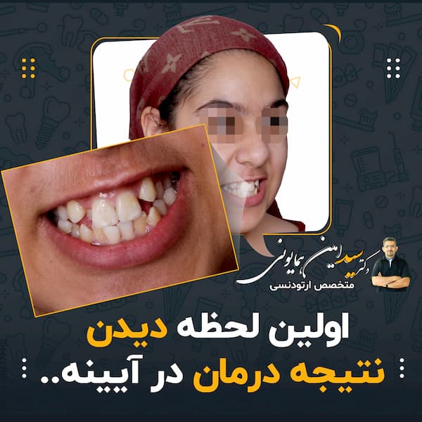 لحظه دیدن نتیجه درمان در آیینه