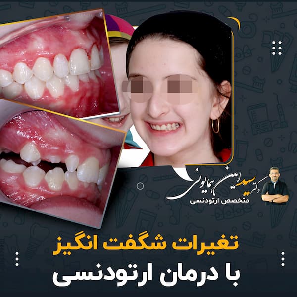 حیرت انگیز با درمان ارتودنسی