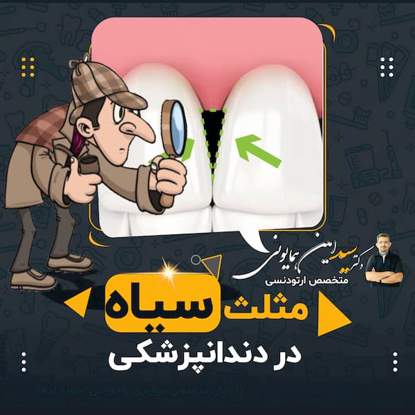 سیاه در دندانپزشکی نوشتهع