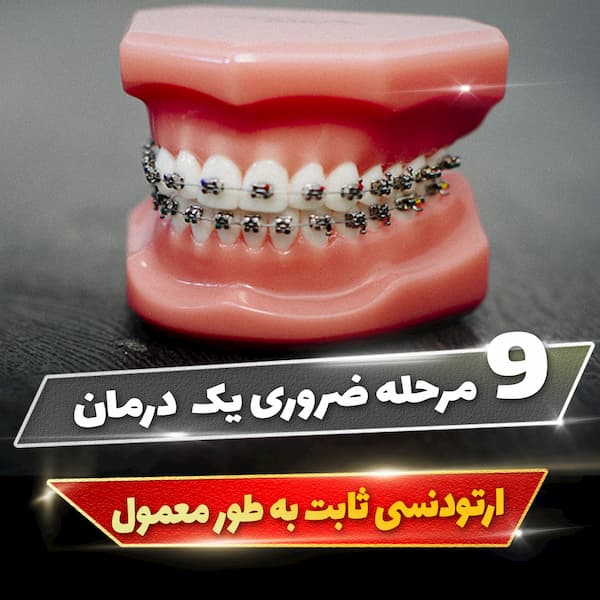 9 مرحله ضروری یک درمان ارتودنسی ثابت به طور معمول