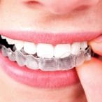 transparent orthodontics1