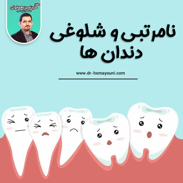نامربتی و شلوغی دندان ها