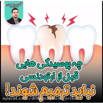 ترمیم دندان پوسیده