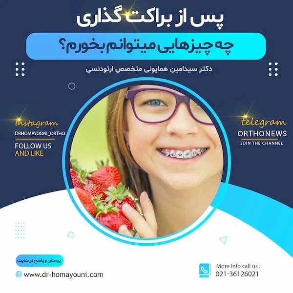 چه چیزیهایی بخورم