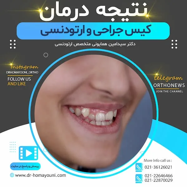 درمان