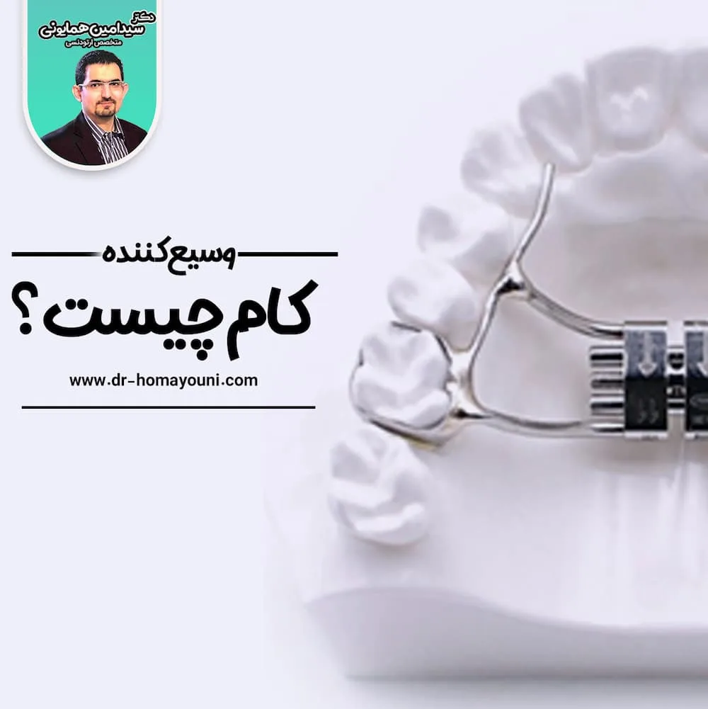 وسیع کننده کام