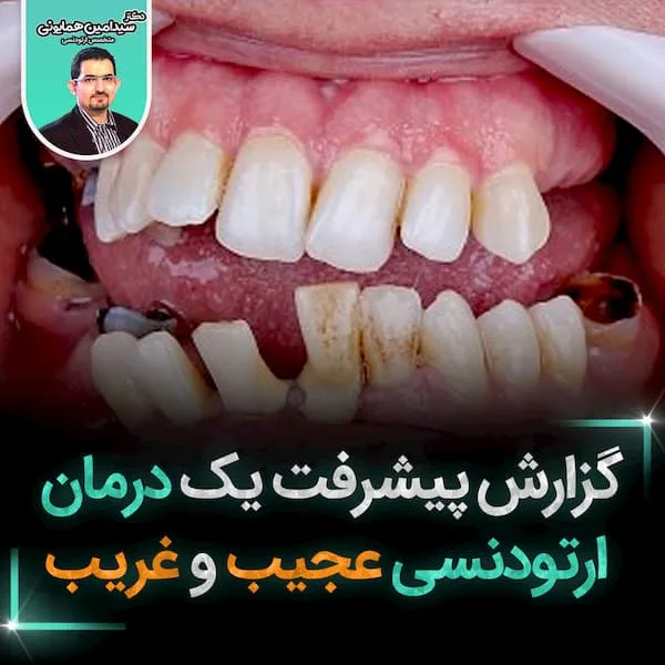 گزارش پیشرفت
