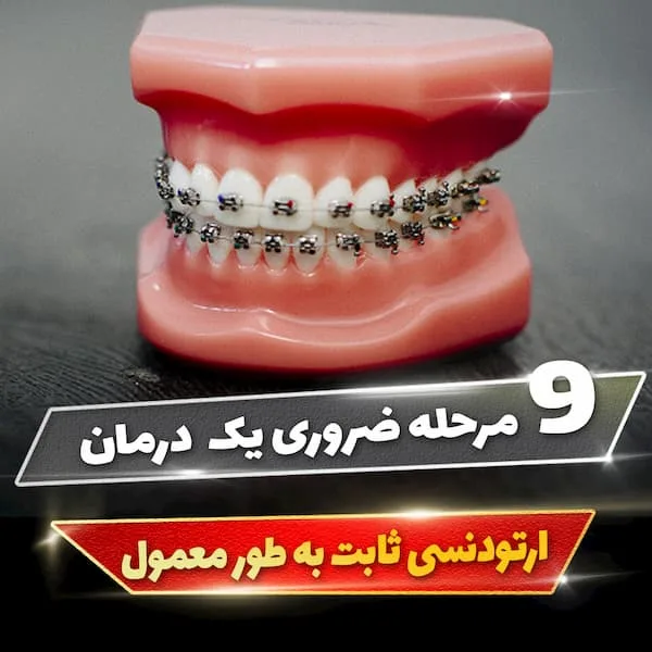 9 مرحله ضروری یک درمان ارتودنسی ثابت به طور معمول